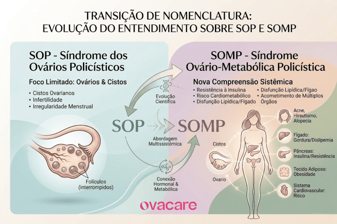 SOMP: Reclassificação Diagnóstica e o Futuro da Saúde Feminina - Ovacare